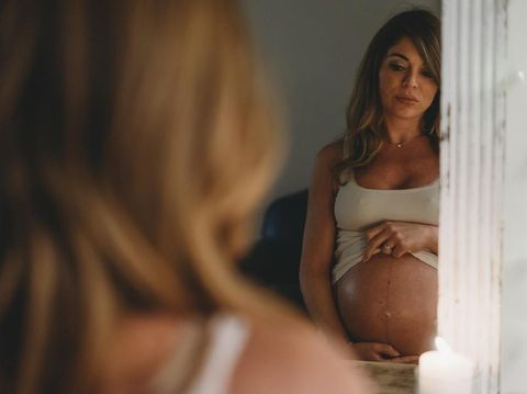 ilustrasi stretch mark