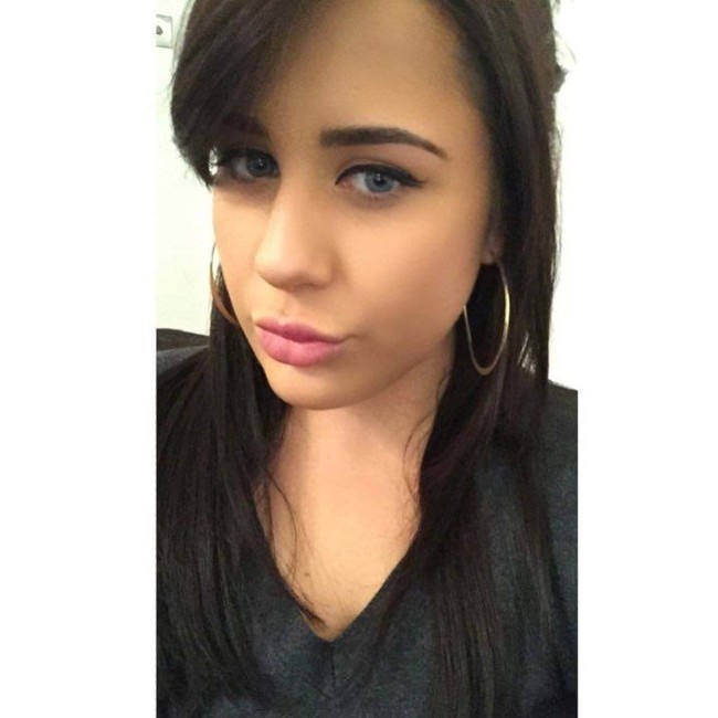 Sebelumnya dada Chloe ditimpa oleh Henry hingga tak bisa bernapas. Saat itu aku tahu aku akan mati, ujar Chloe kepada The Sun. Saat kejadian tesebut, kepada Chloe sudah bocor dengan darah dimana-mana. Jarinya pun sampai patah.  Foto: dok. Instagram