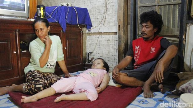 Hidrosefalus, Bocah 7 Tahun di Cipatat Tak Berdaya