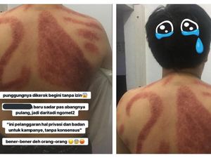 Viral Kerokan Motif Baliho Pilpres, Begini Cerita Sebenarnya