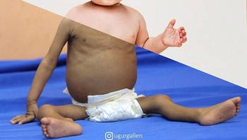 Seperti foto ini, puluhan ribu like diberikan. Foto: Uğur Gallenkuş