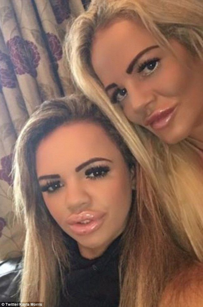 Namun, satu hal yang mengejutkan adalah Georgina meminta Kayla menjual diri kepada para sugar daddy demi membiayai operasi plastiknya. Kayla yang juga ketagihan operasi plastik lantas mengiyakan permintaan sang ibu. (Foto: Ist.)