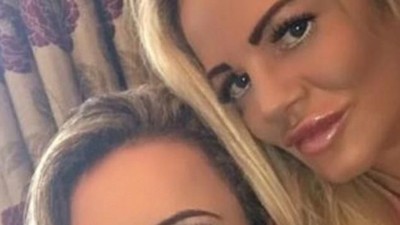 Foto: Demi Mirip Model Seksi, Ibu-Anak Habiskan Rp 1 M untuk Oplas