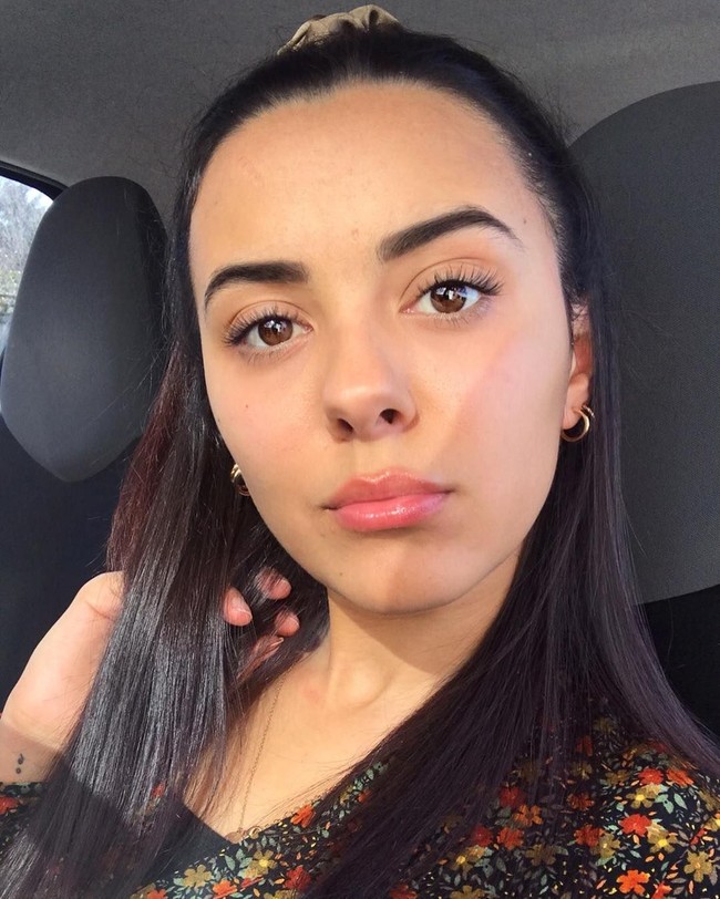 Mandi jadi sesuatu yang sangat mahal untuknya. Biasanya, ia memilih waktu di pagi hari ini mandi dengan durasi yang sangat cepat. Di pagi hari, ia akan langsung beraktivitas sehingga bisa sedikit mengalihkan perhatiannya dari rasa gatal yang didera setelah mandi. Foto: Instagram/Cherelle Farrugia