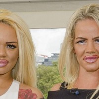 Total, ibu-anak ini telah menghabiskan 56.000 pound atau sekitar Rp 1 miliar hanya untuk operasi plastik. Dan itu masih berlanjut. Kami semakin mirip dengan Katie Price tapi masih banyak yang ingin diubah lagi, kata Kayla. (Foto: Ist.)