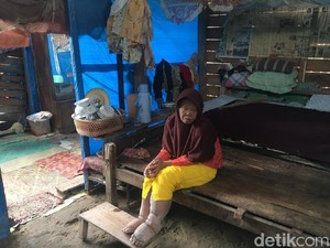 Cerita Nenek Rohana Penderita Lepra Hidup Terkucilkan di Polewali