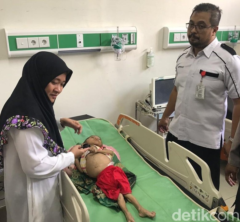 Tubuh Balita di Mojokerto Kaku Mirip Boneka karena Ada Kerusakan Otak Tubuh Balita di Mojokerto Kaku Mirip Boneka karena Ada Kerusakan Otak