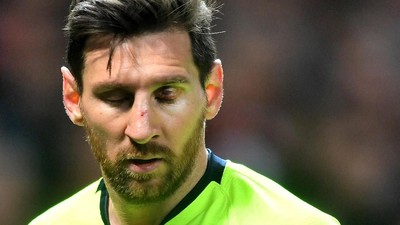 Wajah Messi Berdarah-darah di Laga MU vs Barcelona
