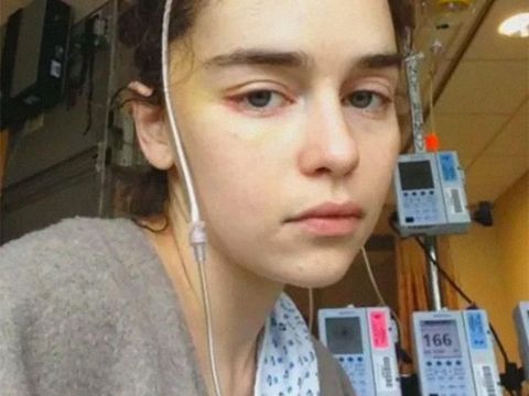 Emilia Clarke saat sedang menderita penyakit stroke.
