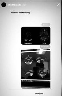 Ariana Grande memamerkan pindaian otaknya yang terkena trauma.