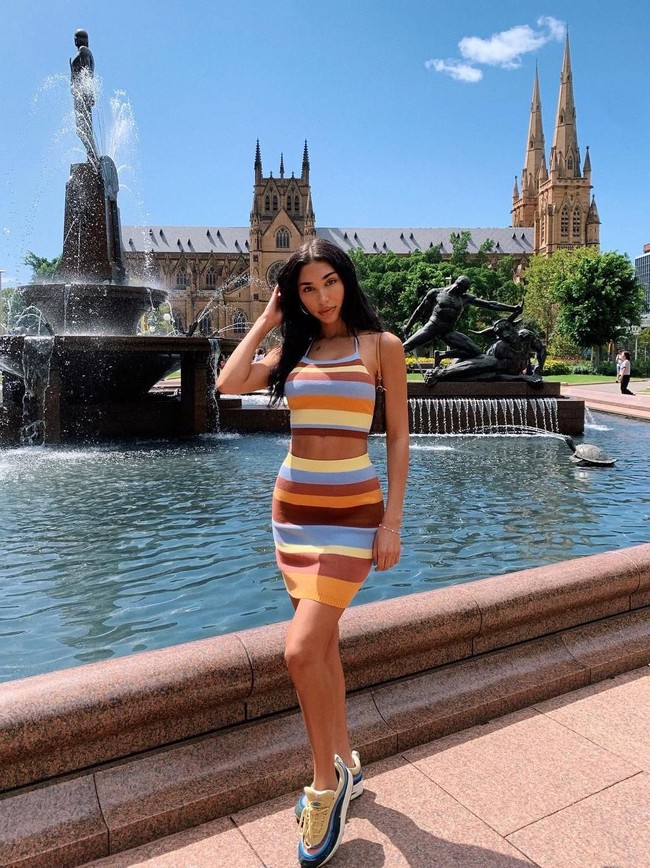 Tak sampai di situ, Chantel pun melakukan botox dan filler di berbagai sisi wajahnya. Hingga wajahnya yang dulu dan sekaran terlihat kontras perbedaannya.  Foto: Instagram