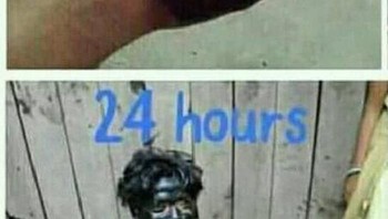 Edisi tintanya nyebar ke seluruh badan. Foto: 1Cak