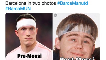 Penampilan Jones sebelum dan setelah pertandingan lawan Barcelona. Foto: istimewa