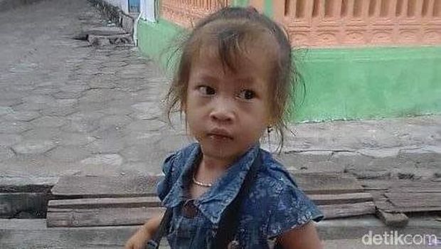 Alfi Khairunafiah, balita asal Rembang yang hilang.