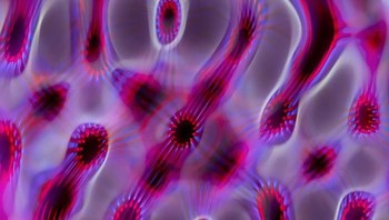 Membran tersebut kemudian diosilasi dengan frekuensi yang spesifik menggunakan amplifier yang ditenagai oleh virtual tone generator.  Foto: Linden Gledhill