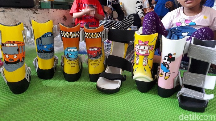 Sepatu ortosis untuk anak-anak pengidap cerebral palsy (Foto: Widiya Wiyanti/detikHealth) Sepatu ortosis untuk anak-anak pengidap cerebral palsy (Foto: Widiya Wiyanti/detikHealth)