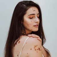 Cacian tersebut tentu sempat membuatnya minder dengan penampilan. Untungnya, kini Alba tidak lagi merasa demikian bahkan sudah percaya diri untuk jadi model. Foto: Instagram @albaparejo_