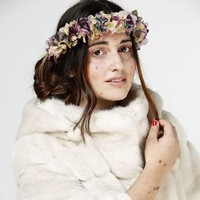 Aku sekarang menyadarai bahwa kulitku cantik, spesial, dan unik. Aku sudah jadi model pusat perbelanjaan Anec Blau dan model untuk pekerjaan para seniman, ungkap wanita asal Spanyol ini dengan bangga. Foto: Instagram @albaparejo_