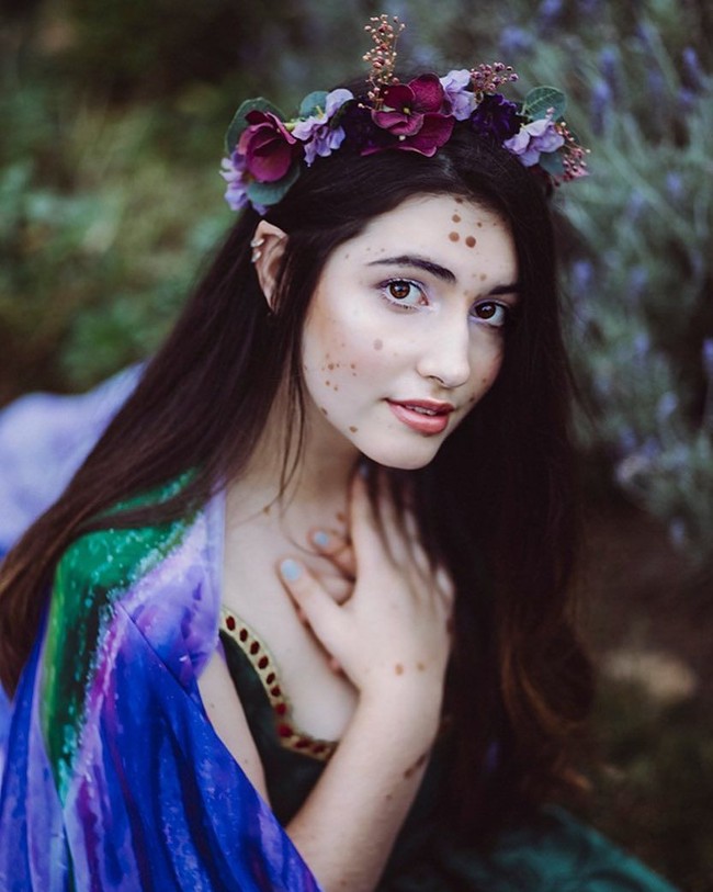 Hal paling buruk yang aku dengar adalah saat seseorang berkata, jangan tunjukkan punggungmu pada siapapun karena tidak ada yang mau punya teman cacat, kata Alba pada Dailymail. Foto: Instagram @albaparejo_