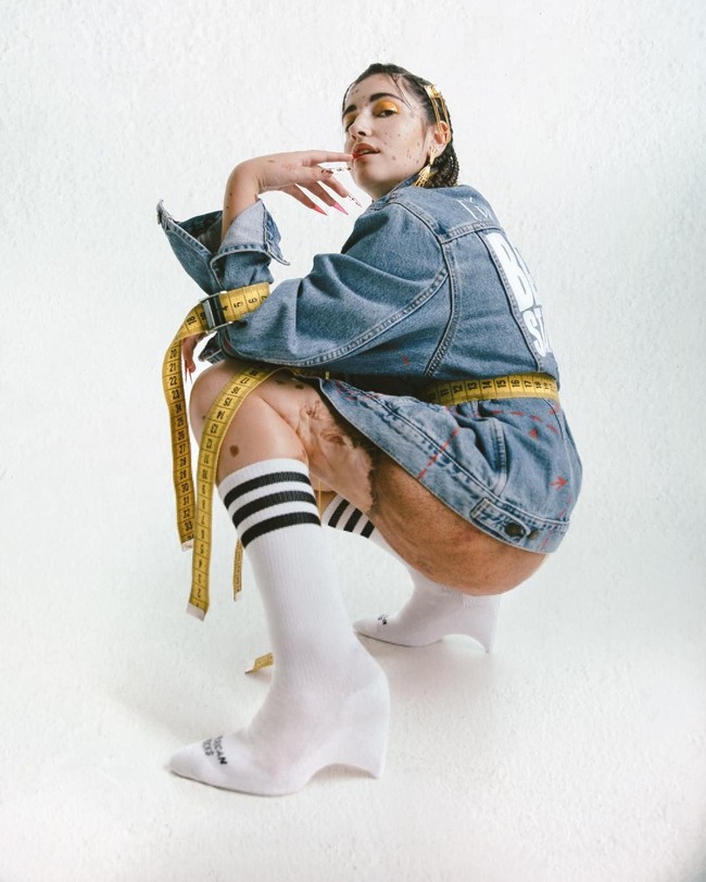 Setelah menerima kondisi tubuh, tak disangka Alba membuka peluang karier. Ia pun mengikuti sebuah kompetisi bertema positivitas tubuh dan memenangkannya. Setelah itu, Alba mendapat kesempatan untuk membintangi sejumlah iklan dan jadi model untuk seniman. Bukan hanya di Instagram, fotonya bahkan sudah terpampang di koran, billboard, dan bis. Foto: Instagram @albaparejo_