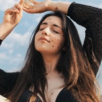 Aku memilih untuk lebih terbuka mengenai kondisiku dan mengunggah foto kulitku di Twitter, berpikir itu hanya akan dilihat teman-temanku tapi aku salah. Aku dihubungi orang-orang dari seluruh dunia, berkata betapa aku menginspirasi dan itu menolongku untuk mencintai diriku sendiri dan kulitku, tambahnya. Foto: Instagram @albaparejo_