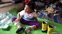 Sepatu orthosis diberikan gambar sesuai karakter animasi yang disukai oleh anak-anak. Foto: Widiya Wiyanti/detikHealth