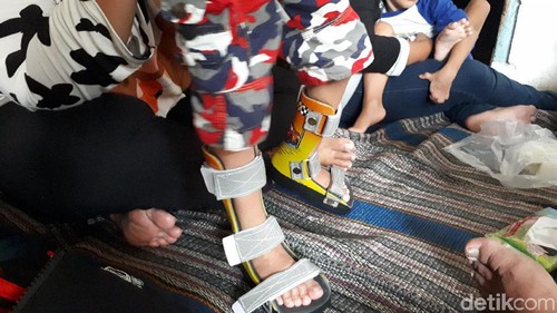 sepatu ortosis cerebral palsy