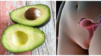 Rahim atau uterus memiliki bentuk yang mirip seperti buah alpukat yang terbelah dua. Alpukat juga punya beberapa manfaat untuk kesehatan reproduksi wanita. Foto: Womans Day