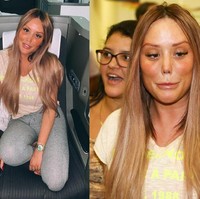 Penampilannya semakin dikritik baru-baru ini. Netizen menyebutnya kebanyakan botox dan memintanya untuk berhenti melakukan tindakan.  Foto: dok. Instagram, Getty Images