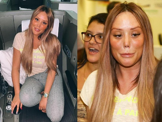 Penampilannya semakin dikritik baru-baru ini. Netizen menyebutnya kebanyakan botox dan memintanya untuk berhenti melakukan tindakan.  Foto: dok. Instagram, Getty Images