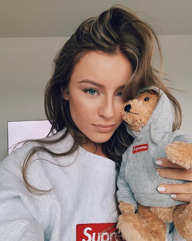 Aku tidak melihat perubahan kulit yang berarti, seperti dia memiliki sesuatu yang disuntik buatan. Aku tidak melihat sayatan kecil yang mengarah pada perpindahan lemak, ujarnya. Foto: Instagram @daisykeech