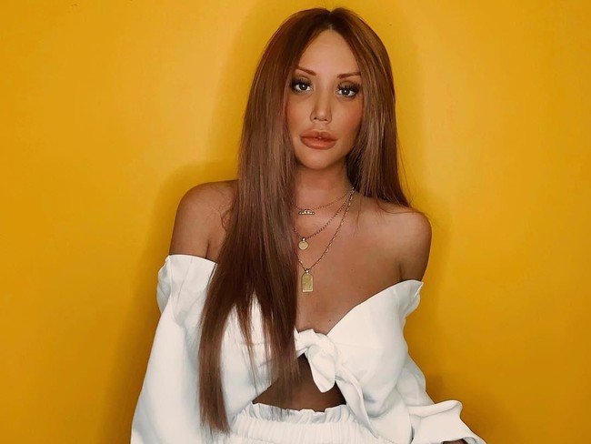 Perubahannya pun semakin ektrem. Tampak dia melakukan botox dan filler di sana-sini. Terlihat jelas bahwa bentuk hidungnya kini telah berubah.  Foto: Instagram