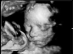 Sudah Jadi Selebgram Sejak di Kandungan