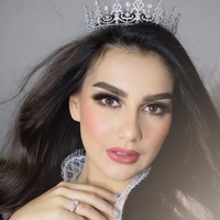 Dalam penampilannya kali ini, Irish Bella dipuja-puji oleh netizen karena kecantikannya. Banyak yang menyebutnya bak ratu telenovela Thalia. Rosalinda...bnr mirip bngt ma Thalia...telenovella, tulis salah satu netizen. duuuh ada kata diatas cantik gak sih..... Rosalinda bgt ini sih kebangetan cantiknya, tambah netizen lainnya.  Foto: Instagram @bennusorumba