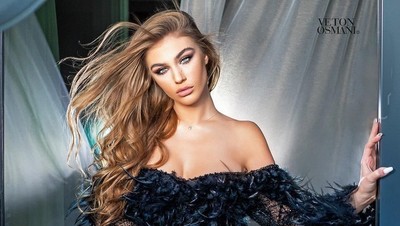 Gaya Seksi Miss Universe Albania, Kontroversial Karena Dulu Tukang Bully