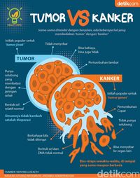 Tumor Vs Kanker, Bedanya Apa Sih?