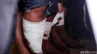 Para pelaku dihadirkan dengan kaki dibalut perban dan berjalan dengan pincang karena ulahnya. 