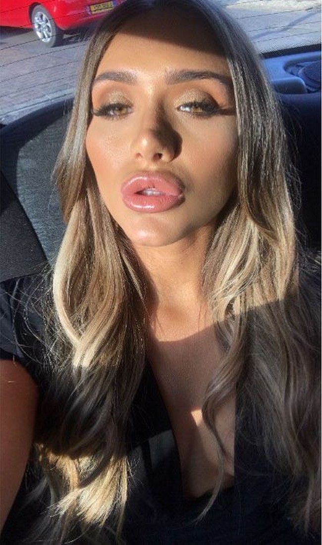 Penampilannya tersebut sudah bisa dipastikan bukan wajah aslinya, melainkan efek botox dan filler. You were great on the first episode but the lips are a noooo stay natural, tulis netizen Foto: Instagram