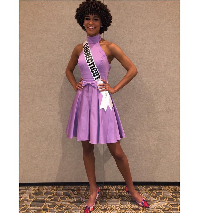 Dalam wawancara dengan Refinery29, Kaliegh mengatakan keputusannya untuk tampil dengan rambut alaminya yang kribo di Miss Teen USA 2019 sempat diremehkan oleh followers-nya di Instagram. Ada yang bilang aku lebih cantik dengan rambut lurus. Ada juga yang menyarankan aku melakukan ekstensi atau meluruskan rambut, katanya. Sebelumnya Kaleigh memang pernah tampil dengan rambut lurus. Namun sejak Agustus 2017, dia memilih tak lagi meluruskan rambut dan membiarkan rambut keriting alaminya menjadi mahkotanya. Foto: Dok. Instagram