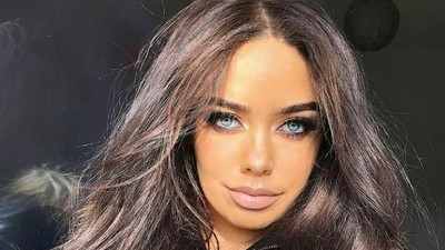 Youtuber Cantik Ini Dulu Diisukan Bunuh Diri, Kini Nyaris Kehilangan Bibir