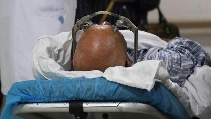 Pasien menjalani eksperimen implan otak untuk menyembuhkan kecanduan narkoba. (Foto: ABC) Pasien menjalani eksperimen implan otak untuk menyembuhkan kecanduan narkoba. (Foto: ABC)