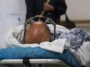 Ilmuwan China Uji Implan Otak untuk Sembuhkan Kecanduan Narkoba