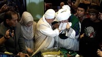 Ia pun sempat menunjukan rambut tersebut  sahabatnya Derry Sulaiman. Dok. Ist