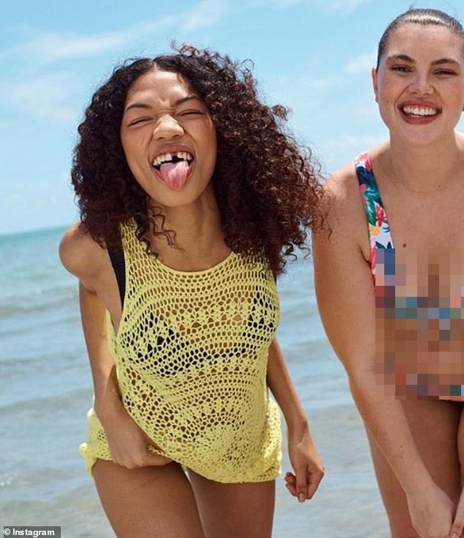 Wajah Symone Lu baru-baru ini juga mengisi kampanye retailer fashion Inggris, Primark. Di iklan itu, Symone tertawa lebar dan menunjukkan giginya yang tak rapi. Foto: dok. Primark