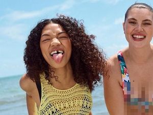 Brand Primark Dipuji karena Tampilkan Model yang Gigi Depannya Ompong