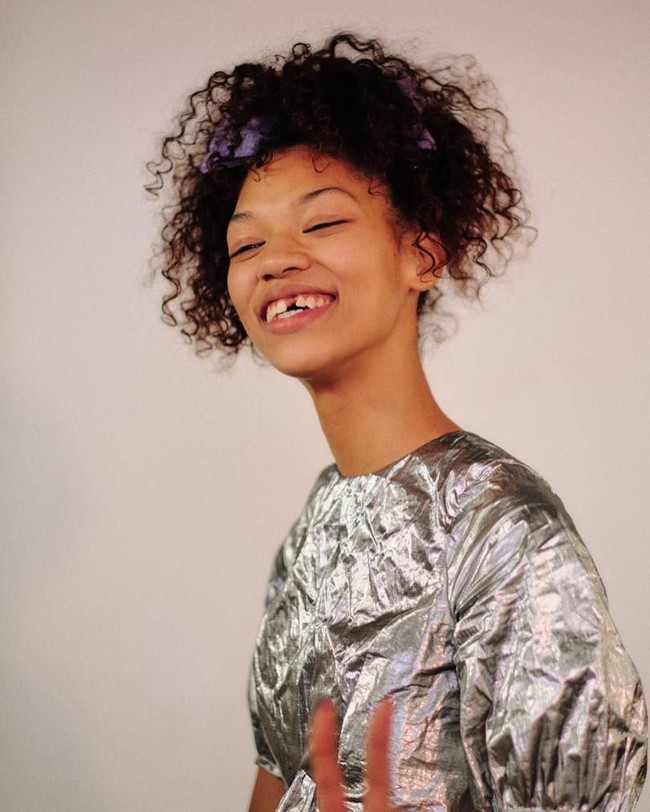 Symone mendapat dukungan dari internet yang membelanya karena terlihat percaya diri dengan gigi ompong. Orang-orang di dunia maya menganggap ia sebagai inspirasi karena memiliki kepercayaan diri yang besar. Foto: Instagram @symone_lu