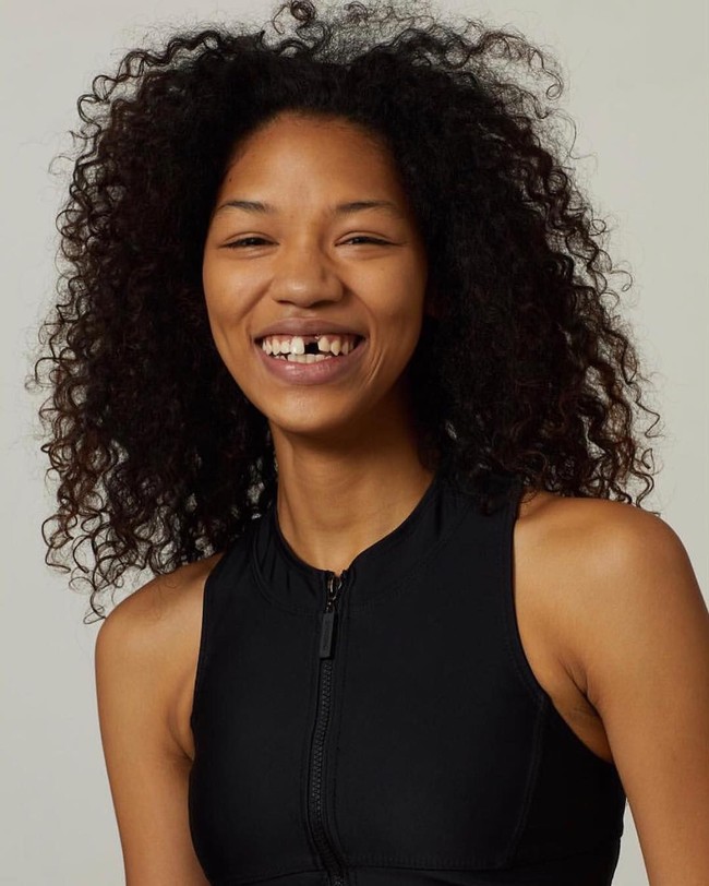 Symone Lu, wanita asal New York ini dikenal sebagai model. Namun tak seperti model kebanyakan yang tampak memiliki gigi sempurna ketika tersenyum, Symone justru populer karena gigi ompongnya di bagian depan. Foto: Instagram @symone_lu