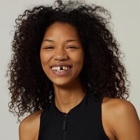 Symone Lu, wanita asal New York ini dikenal sebagai model. Namun tak seperti model kebanyakan yang tampak memiliki gigi sempurna ketika tersenyum, Symone justru populer karena gigi ompongnya di bagian depan. Foto: Instagram @symone_lu