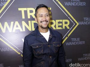 Kocak! Dibilang Oplas Hidung, Tora Sudiro Balas Netizen Ini