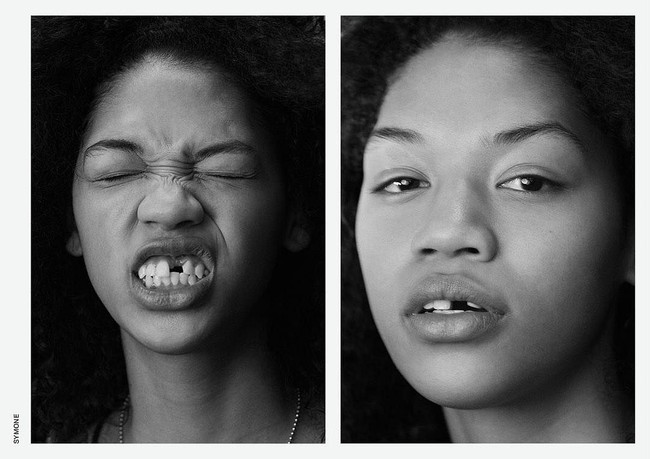 Model 21 tahun ini menjadi terkenal justru ketika ia menjadi bahan lelucon di dunia maya. Sebuah akun Twitter kala itu mengejeknya karena memiliki gigi ompong saat tersenyum. Foto: Instagram @symone_lu